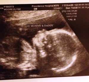 Layne at 19 weeks in August 2012.